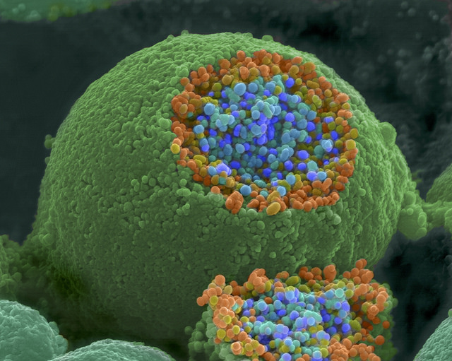 A scanning electron microscope picture of a nerve ending.